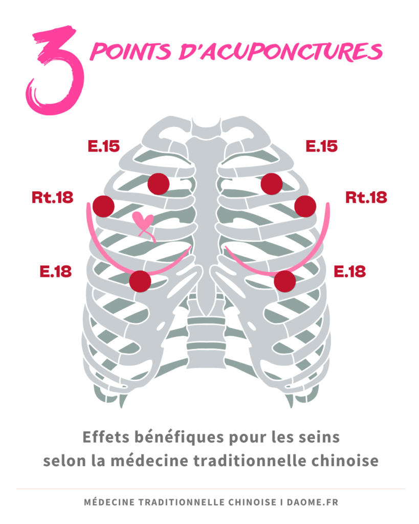 points acuponcture pour soulager les seins